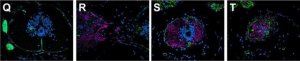 Anti-Laminin antibody produced in rabbit 