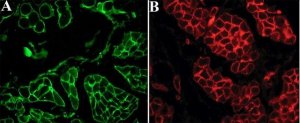 Anti-Laminin antibody, Mouse monoclonal SAB4200719-100UL