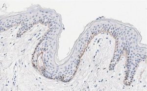 Anti-Laminin-5 2 Antibody, clone D4B5 ZooMAb Mouse Monoclonal 