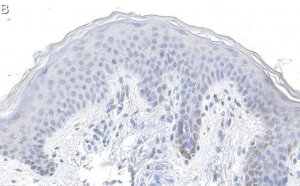 Anti-Laminin-5 2 Antibody, clone D4B5 ZooMAb Mouse Monoclonal 
