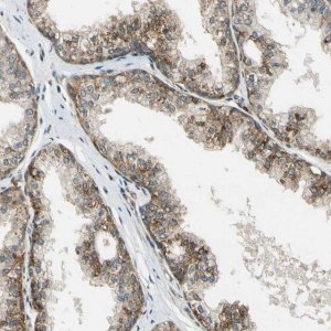 ANTI-LAMTOR1 antibody produced in rabbit 
