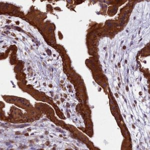 Anti-LARP4 antibody produced in rabbit 