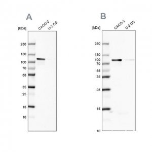 Anti-LARP4B antibody produced in rabbit 
