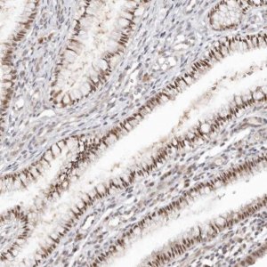 Anti-LARP7 antibody produced in rabbit HPA027930-100UL