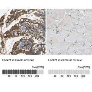 Anti-LASP1 antibody produced in rabbit 