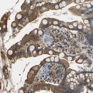Anti-LASP1 antibody produced in rabbit 