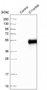 Anti-LBHD1 antibody produced in rabbit 