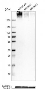 Anti-LBR antibody produced in rabbit 