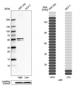Anti-LBR antibody produced in rabbit 