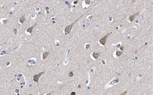 Anti-LC3A Antibody, clone 3J12 ZooMAb Rabbit Monoclonal 