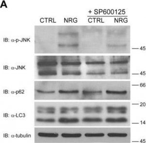 Anti-LC3B antibody produced in rabbit 