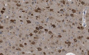 Anti-LC3B Antibody, clone 12K5, ZooMAb Rabbit Monoclonal 