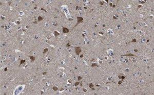 Anti-LC3B Antibody, clone 12K5, ZooMAb Rabbit Monoclonal 