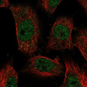 Anti-LCAT antibody produced in rabbit 