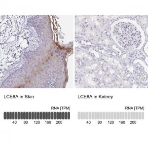Anti-LCE6A antibody produced in rabbit 