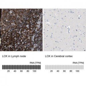 Anti-LCK antibody produced in rabbit 