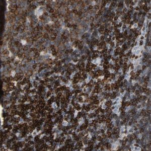 Anti-LCK antibody produced in rabbit 