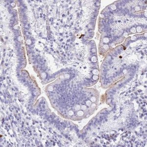 Anti-LCN15 antibody produced in rabbit 