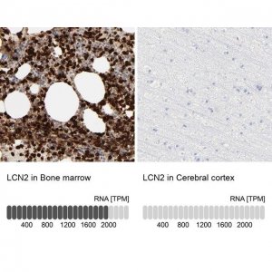 Anti-LCN2 antibody produced in rabbit 
