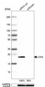 Anti-LCN2 antibody produced in rabbit 