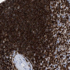 Anti-LCP1 antibody produced in rabbit 