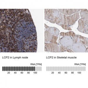 Anti-LCP2 antibody produced in rabbit HPA036396-100UL