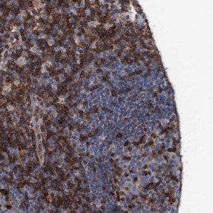 Anti-LCP2 antibody produced in rabbit HPA036396-100UL
