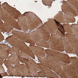 Anti-LDB3 antibody produced in rabbit 