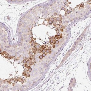 Anti-LDHAL6B antibody produced in rabbit 