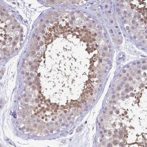 Anti-LDHC antibody produced in rabbit 
