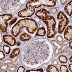 Anti-LDHD antibody produced in rabbit 