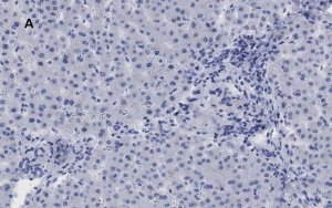 Anti-LDL Receptor Antibody, clone 2N19, ZooMAb Rabbit Monoclonal 