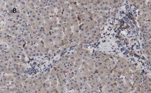 Anti-LDL Receptor Antibody, clone 2N19, ZooMAb Rabbit Monoclonal 
