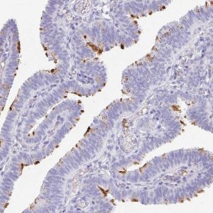 Anti-LDLRAD1 antibody produced in rabbit 