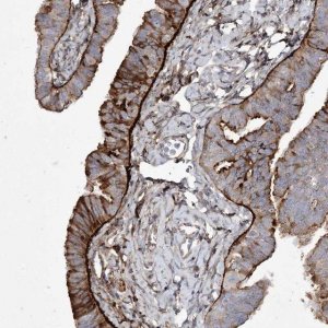 Anti-LDLRAD3 antibody produced in rabbit HPA038251-100UL