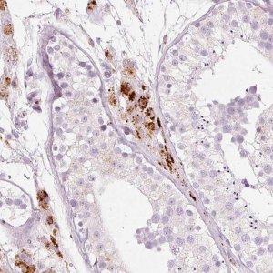 Anti-LECT2 antibody produced in rabbit 