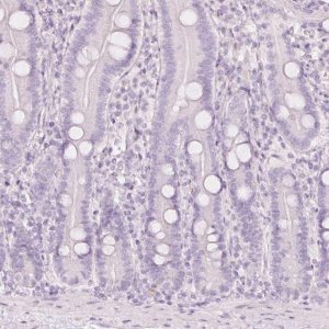 Anti-LECT2 antibody produced in rabbit 
