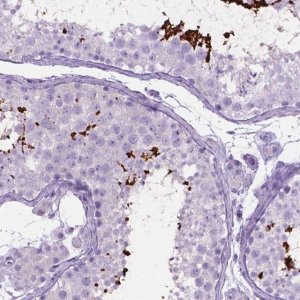 Anti-LELP1 antibody produced in rabbit 