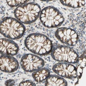 Anti-LETM1 antibody produced in rabbit 