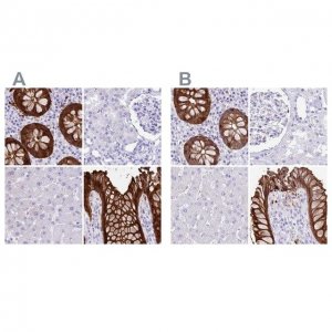 Anti-LGALS4 antibody produced in rabbit 