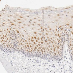 Anti-LGALS7 antibody produced in rabbit HPA001549-100UL