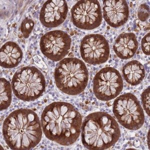 Anti-LGALS9 antibody produced in rabbit 
