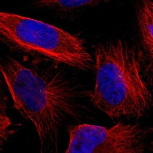 Anti-LGI2 antibody produced in rabbit 