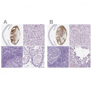 Anti-LGSN antibody produced in rabbit 