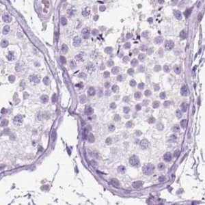 Anti-LGSN antibody produced in rabbit 