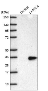 Anti-LHFPL5 antibody produced in rabbit 