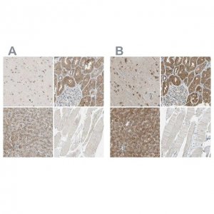 Anti-LHPP antibody produced in rabbit 