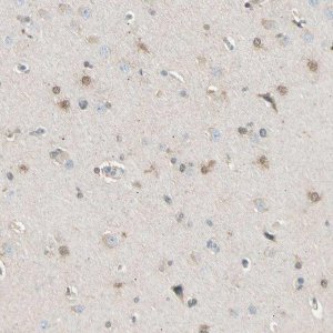 Anti-LHPP antibody produced in rabbit 