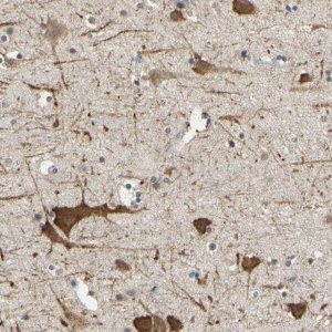 Anti-LHX9 antibody produced in rabbit 
