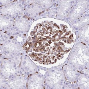Anti-LIMS2 antibody produced in rabbit 